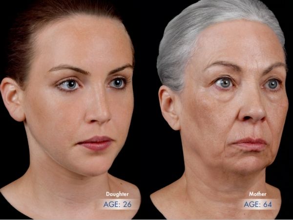 starenje lica i kože