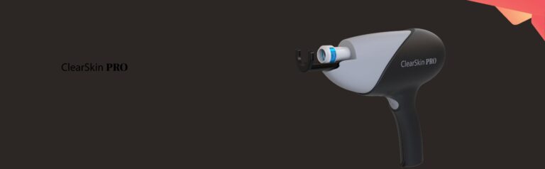 ClearSkin laser
