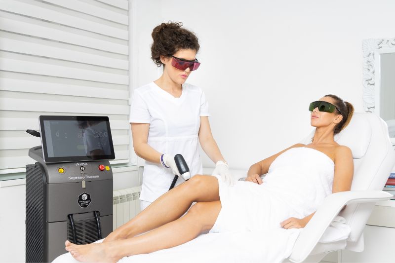 laserska epilacija laser hair removal