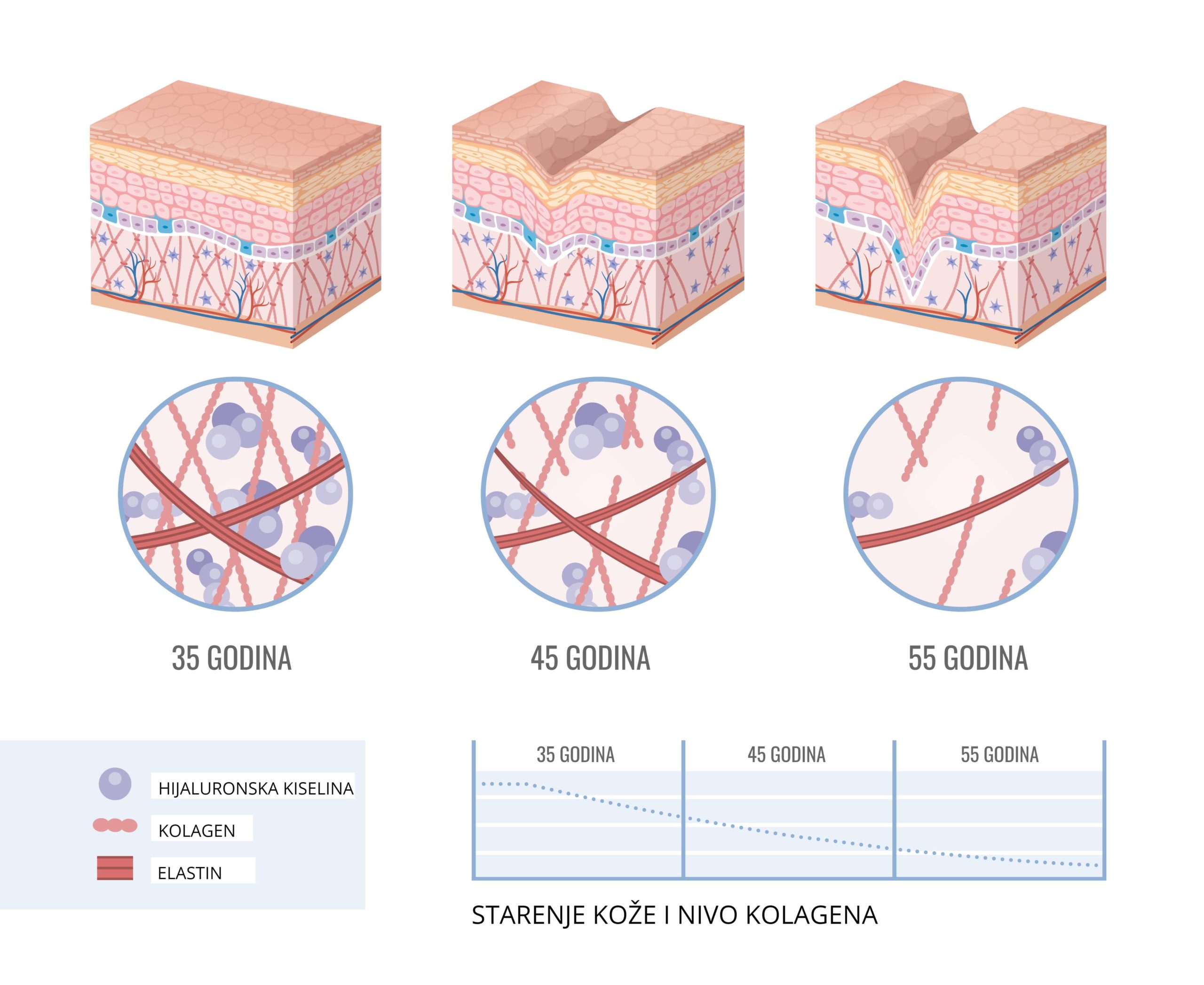 kolagen elastin hijaluronska kiseliina biorevitalization hyaluronic acid