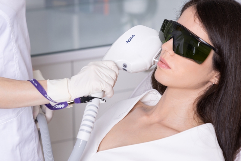 NIR laser zatezanje kože NIR zatezanje kože