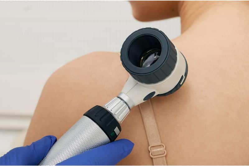dermatološki pregled beograd