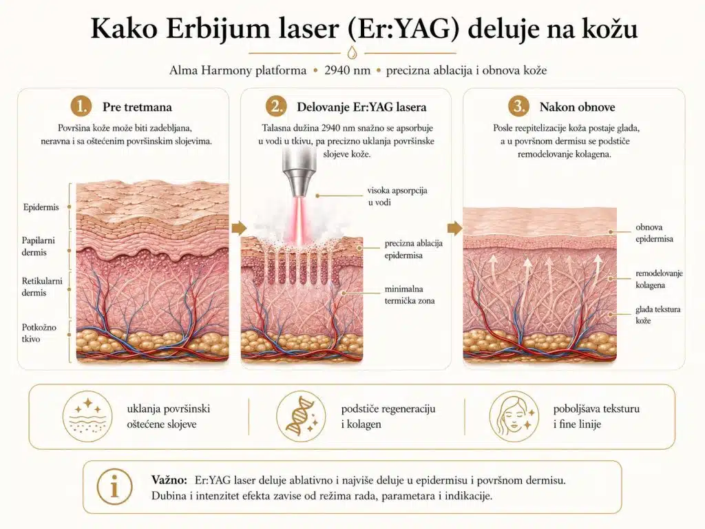 erbijum laser